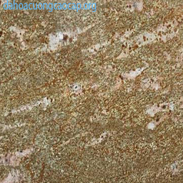 Đá granite