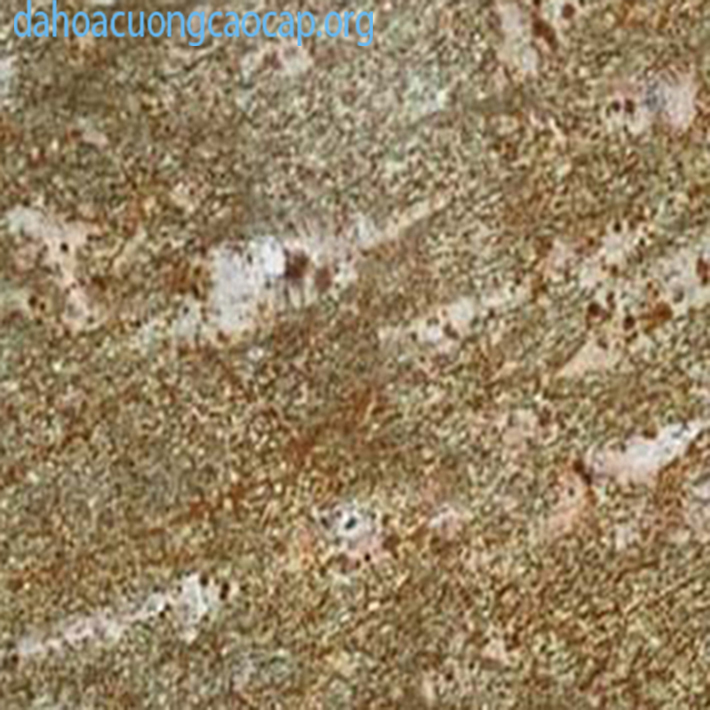 Đá granite